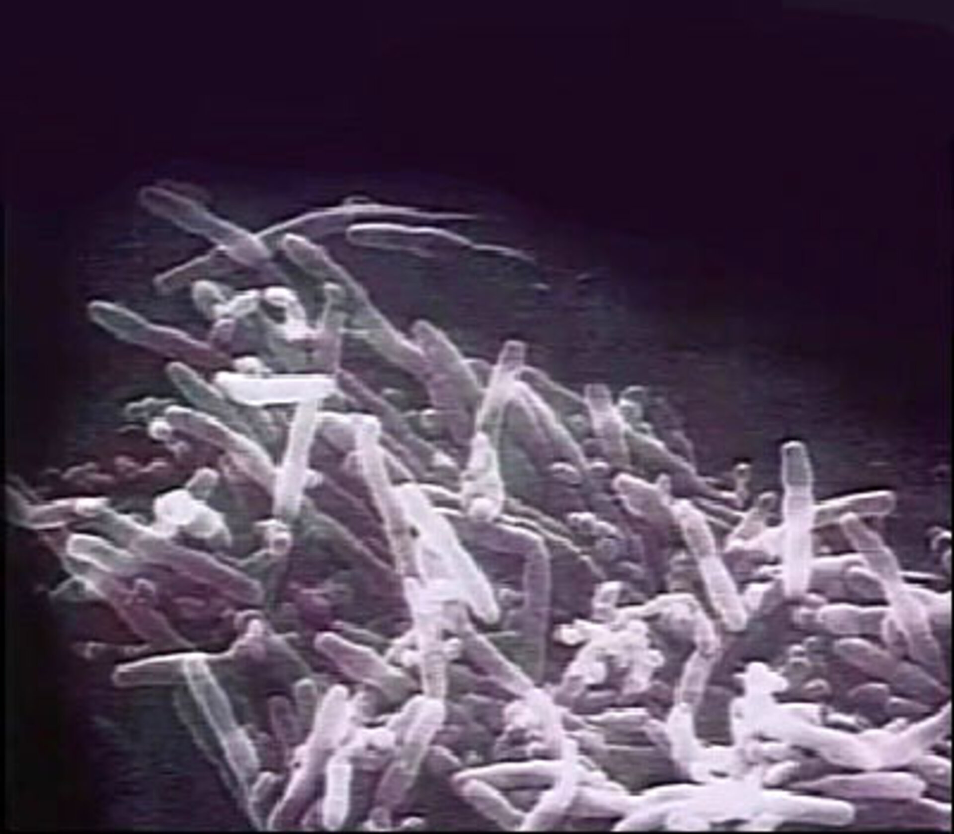 Romteknologi eliminerer farlige bakterier på sykehus